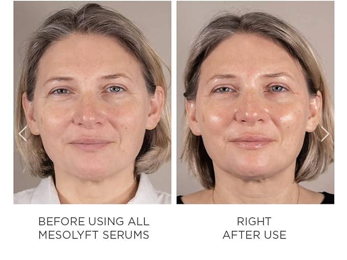 Power Combo Neck & eye Roller Brightening Face Serums for Anti-Aging Get Lip Pump's best Lip Plumper an Effectively Aging Skin Serum Multi-purpose, Eyes Neck & Décolleté Beauty Serum-Velvo Beauty