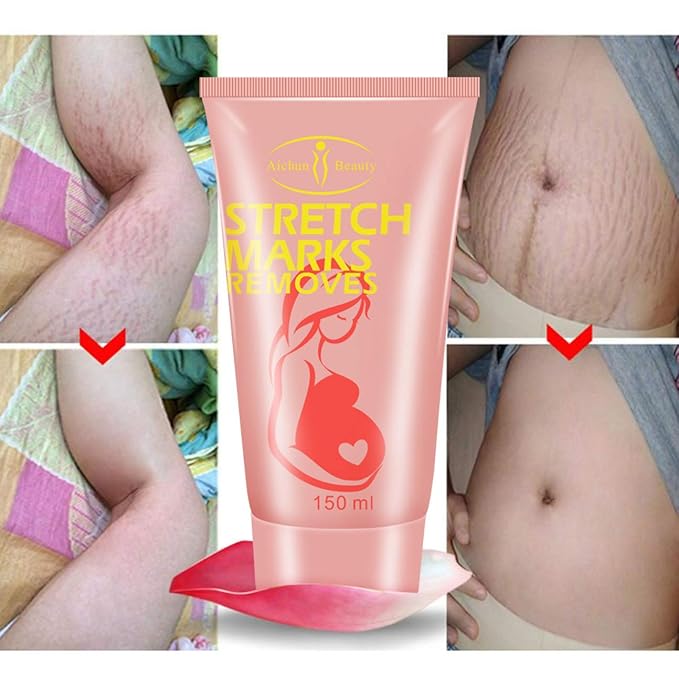 AICHUN BEAUTY Pregnancy Cream Streach Mark Remover Scars Repair Cellulites Lotion Cream 150ml-Velvo Beauty