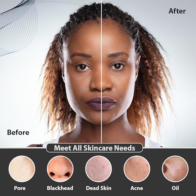 Facial Cleansing Brush | 3-in-1 Electric Face Scrubber | USB Rechargeable Face Cleansing Brush | IPX7 Waterproof | Blackhead Remover | Deep Cleansing & Exfoliating (Black)-Velvo Beauty