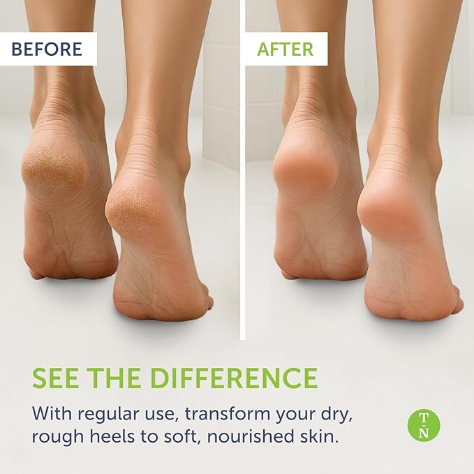 Truremedy Naturals Remedy Balm with Tea Tree Oil, 2 oz - Soothing Moisturizer for Rough Areas - Nourishing Foot and Body Balm with Tea Tree, Lavender, and Eucalyptus-Velvo Beauty