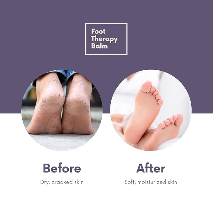 Victoria's Lavender Ultra Rich Foot Balm for Dry Cracked Feet – Heel Repair & Softener with Tea Tree Oil & Lavender – Dry Heels Treatment for Women & Men – Made in USA Foot Balm Stick - 2 Pack (2.5Oz)-Velvo Beauty