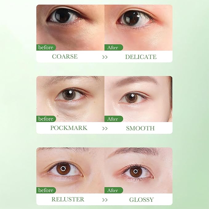 BIOAQUA Centella Asiatica Nourish Repair Eye Cream Soothing Oil Control Anti-Acne 20g / 0.7oz-Velvo Beauty