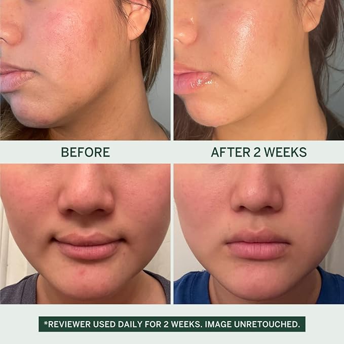 Urban Calm Collection - Fermented Skincare Bundle - for All Skin Types - Anti-Aging Skincare Set for Hydrating, Firming, Exfoliating, Soothing - With Cleanser, Essence, Serum, and Cream-Velvo Beauty