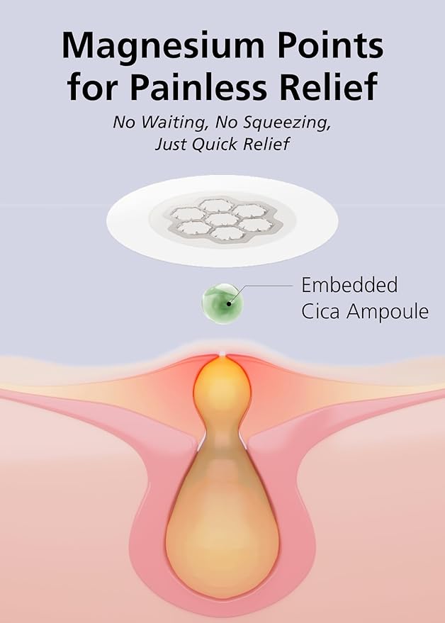 Quick Calming Magnesium Patches(20 patches) with Cica Ampoule - Intensive Care, Pimple patches, Hydrocolloid Band, Zits Spot care Overnight Home Care 2-8 hours, New boxs types-Velvo Beauty