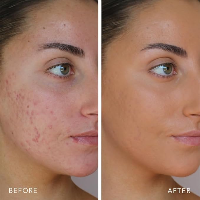 Doll 10 TCE Liquid Filter – CC Cream - Liquid Foundation - Lightweight Tinted Moisturizer & Skin Tint - Blurs Pores & Fine Lines - Vegan - Clean Makeup - [Tan/Deep] - 30 Day Supply-Velvo Beauty