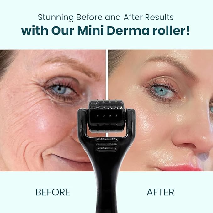Gin Amber Beauty Mini Derma roller (0.25mm) - 48 Real Individual Needles, Microdermabrasion Device for Skin Care, Serum Absorption with Microneedling, Tool, Hygienic Case (Black Mini 0.25mm)-Velvo Beauty