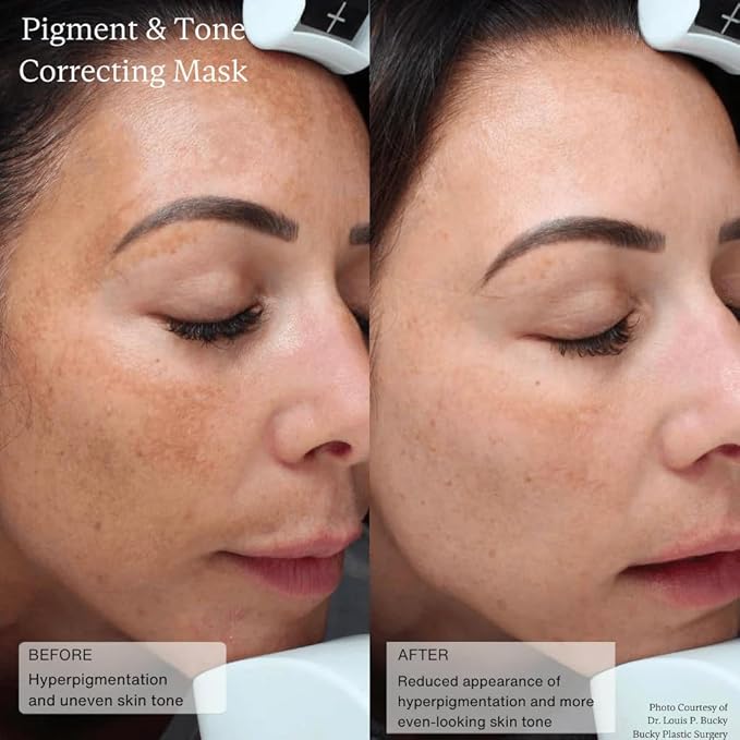 Senté Cysteamine HSA Pigment and Tone Corrector- Hyperpigmentation Treatment For Reducing The Appearance of Dark Spots And Improving Skin Tone - 1.7 Fl Oz-Velvo Beauty