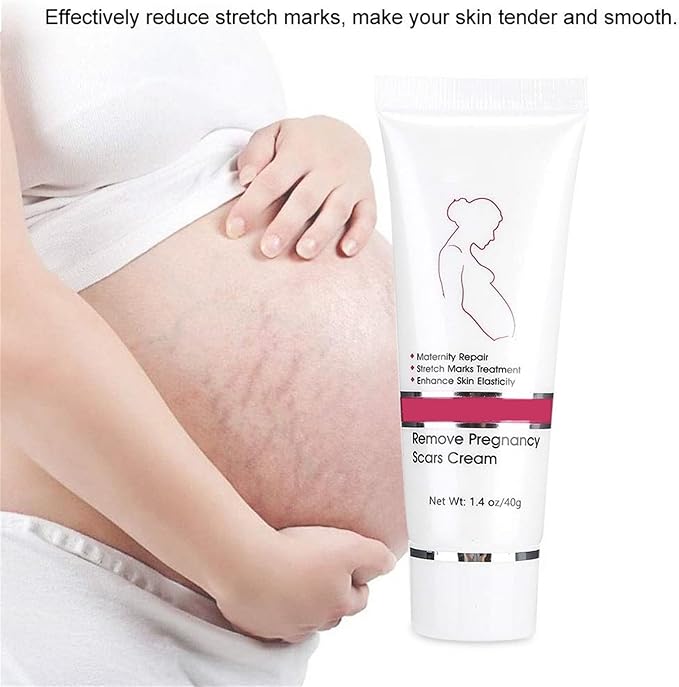 RtopR Stretch Marks and Scar Cream,Crema para Estrias De Embarazo,Stretch Marks Postpartum Repairing Cream Wrinkles Diluting Removal Cream Crema De Cacao para Cicatrices-Velvo Beauty