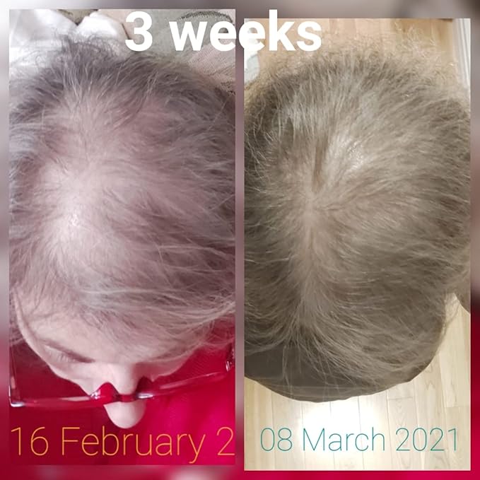 CRISAN 16oz Extreme Hair Growth and Strengthening Oil for Men and Women (16 fl oz)-Velvo Beauty