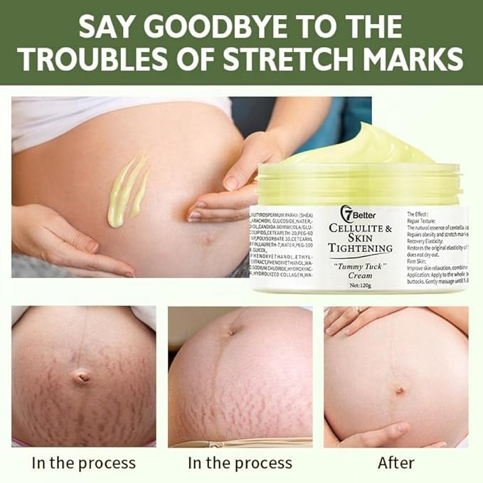 Stretch Marks and Scars Removal Cream for Pregnancy - Scars Repair, Abdominal Firming, and Gentle Stretch Marks Eradication Skincare Body-Velvo Beauty
