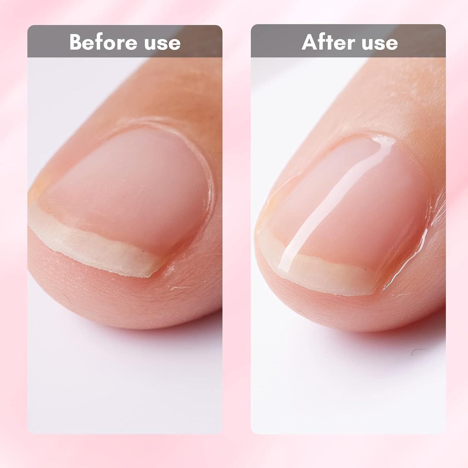 Makartt Gel Nail Strengthener Reinforce Polish, Nail Strengthening Repair Polish Nail Hardener for Treating Weak Damaged Peeling Nails Clear Soak Off Gel Lacquer Long Lasting Professional DIY Nail Art-Velvo Beauty