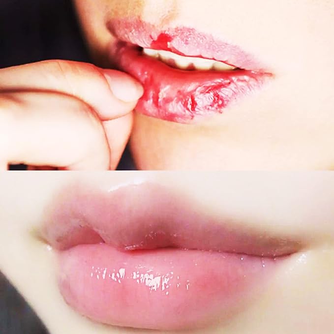 Lip Masks Sheet,Moisturizing Crystal Collagen Gel,Anti-Aging Lip Patches Reduces Lip Lines,Plump Dry Lips Overnight Lip Care,Fall/Winter Collagen Lip Sleep Mask 20 Packs with Box,Red-Velvo Beauty