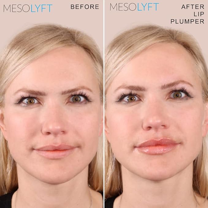 Neck & Lip Plumper Combo with Roller to Instantly Plump Lips & Neck - Neck Serum Improves the Neck Skin - Plumping Serum to Moisturize Your Lips and Neck-Velvo Beauty