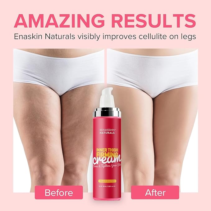 Anti Cellulite Body Firming Cream: Cellulite Remover for Legs & Inner Thigh- Skin Tightening Lotion for Womens' Booty, Stomach & Belly with Acetyl Hexapeptide-8 & Caffeine, 100 ML-Velvo Beauty