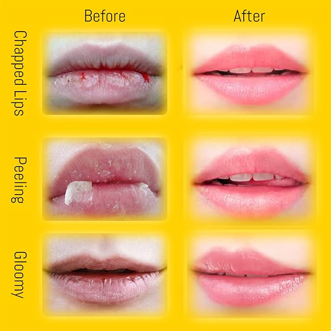 4PCS Lip Balm Honey Pot, Honey Pot Lip Balm for Dry Cracked Lips, Strawberry Lip Balm Scrubs Exfoliator & Moisturizer, Hydrating Lip Balm Honey Pot with Wand, Lip Sleeping Mask (D)-Velvo Beauty