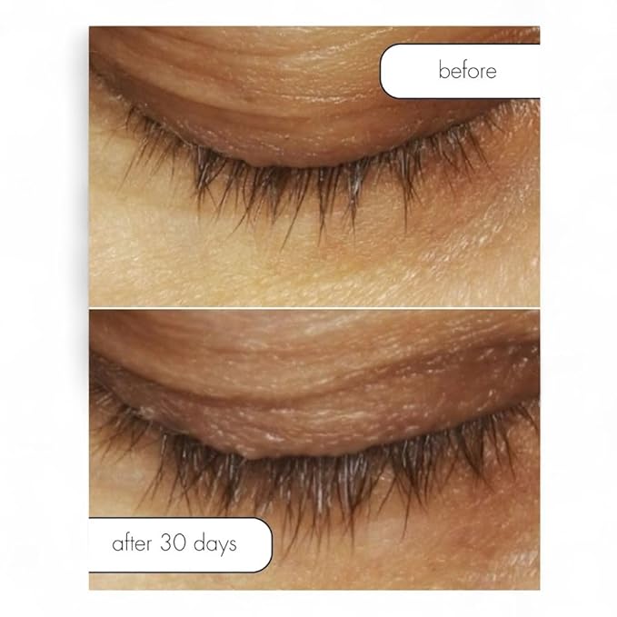 Serious Skincare Lash Bath & Conditioner - Double Action Eye Makeup Remover - Oil Free - Enhancing Peptides Promotes Eyelash Growth - Clover Flower - Effortlessly Removes Waterproof Mascara - 4 oz.-Velvo Beauty