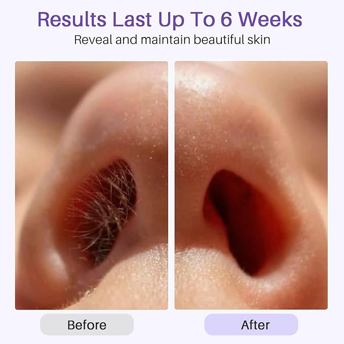 BLITZWAX Single Waxing Pot, Hard Wax Warmer for Face, Legs, Bikini, Brazilian and Body, for 16 oz, At Home Hair Removal Kit, for Men, Beginner Friendly, Quick Heating, Precise Temperature Control-Velvo Beauty