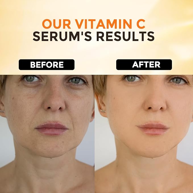 2 Packs Vitamin C Serum for Face –Anti Aging Face & Eye Serum, Hyaluronic Acid, Reduce Fine Lines, Dark Spots and Wrinkle-Velvo Beauty