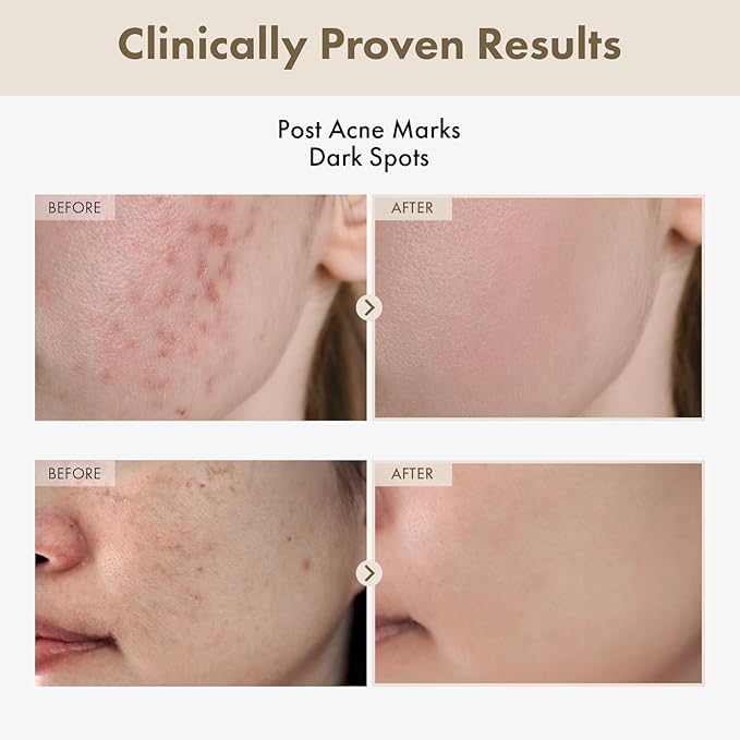 Alpha Arbutin 2% Rice Serum, Rice 746,074ppm, Alpha-Arbutin 20,000ppm, Glow, Glass skin, Pigmentation, Acne Marks, Dark Spots, Even Skin Tone, Hydrating, Korean Skin Care, 33ml / 1.11 fl.oz.-Velvo Beauty