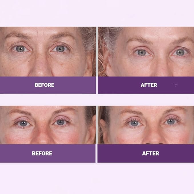 Serious Skincare INSTA-TOX Facial Firming Wrinkle Smoothing Serum and Reverse Lift Firming Eye Cream Set - Filler for Fine Lines, Deep Wrinkles and Pores - Temporary Eye Tightener-Velvo Beauty