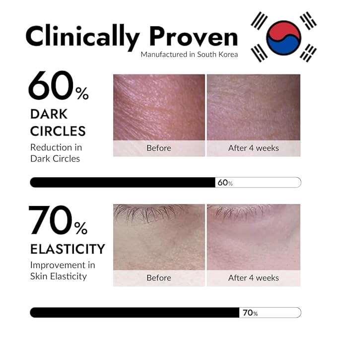 MIZON Under Eye Patches for Puffy Eyes & Dark Circles, 24K Gold & Snail Mucin, 60 Pcs – Anti-Wrinkle Collagen & Peptide Formula – Moisturizing Korean Eye Mask for Elasticity-Velvo Beauty