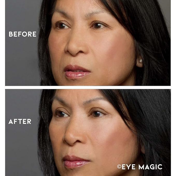 Eye Magic Premium Eye Lift (L/XL Refill) Made in America Lifts and Defines Droopy, Sagging or Hooded Eyes Safe For Daily Use-Velvo Beauty
