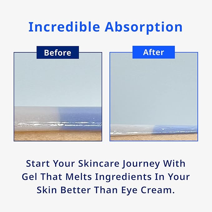 Moist Moment Under Eye Patches | Hydrating Eye Treatment Gel Masks With Hyaluronic acid & Squalane | Under Eye Masks For Dark Circles and Puffiness, Under Eye Bags, Wrinkle Care, Men and Women-Velvo Beauty