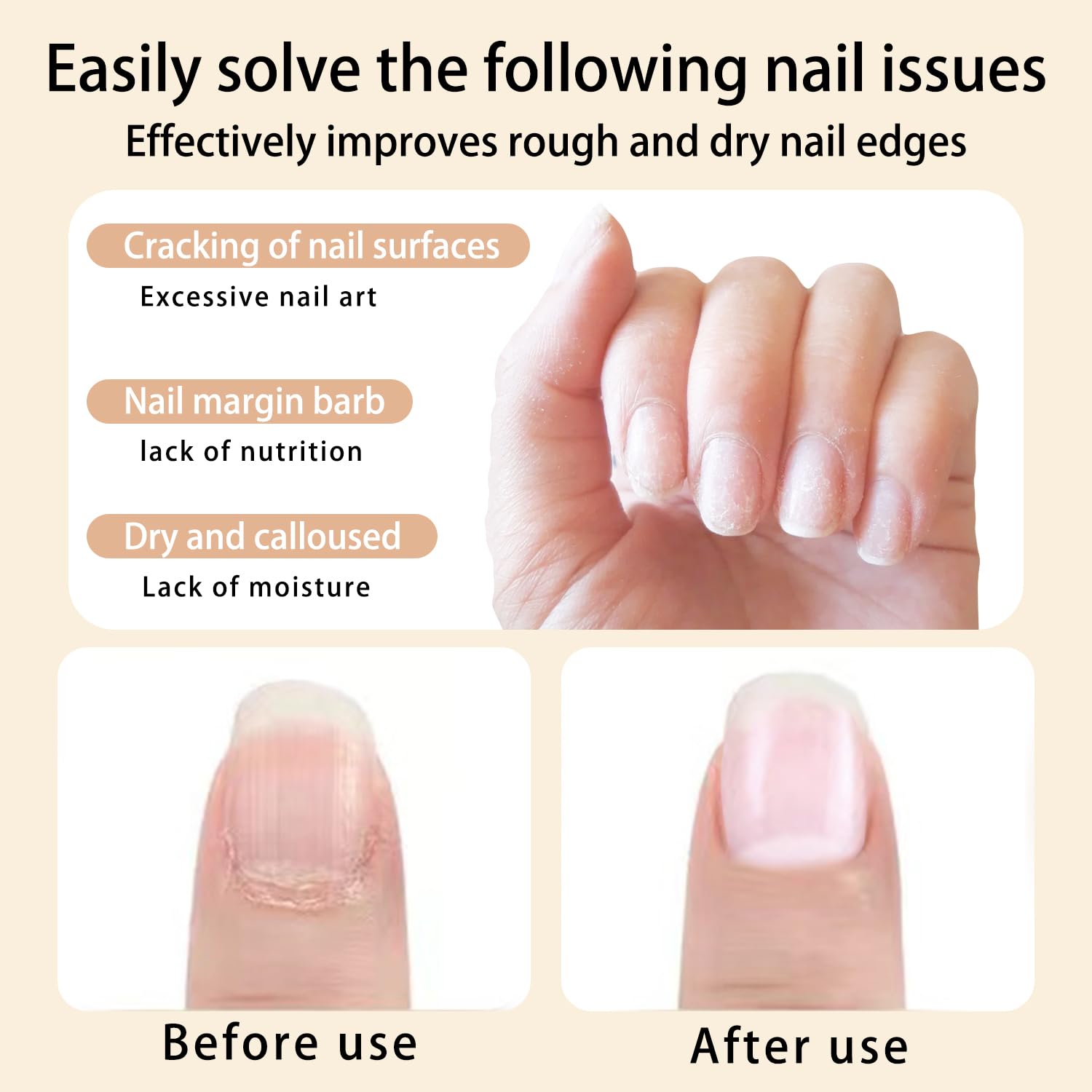 2pcs Cuticle Oil Pen Sweet Almond Nail Growth Serum and Repair Treatment Hydrating Oilfor DryCuticles and Skin CuticleBuddy Revitalize Nailswith Radiant Cosmetics' NailGrowthOil-Velvo Beauty