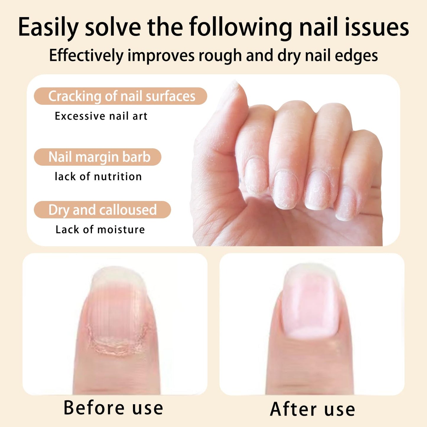 12pcs Cuticle Oil Pen Sweet Almond Nail Growth Serum and Repair Treatment Hydrating Oil for Dry Cuticles and Skin Cuticle Buddy Revitalize Nails with Radiant Cosmetics' Nail Growth Oil-Velvo Beauty