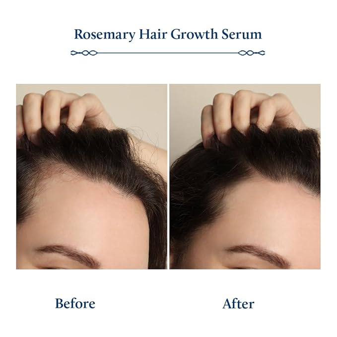 Blue Nectar Hair Growth Serum with Rosemary Oil for Hair Growth | Ayurvedic Hair Tonic Spray (8 Herbs, 3.38 Fl Oz)-Velvo Beauty