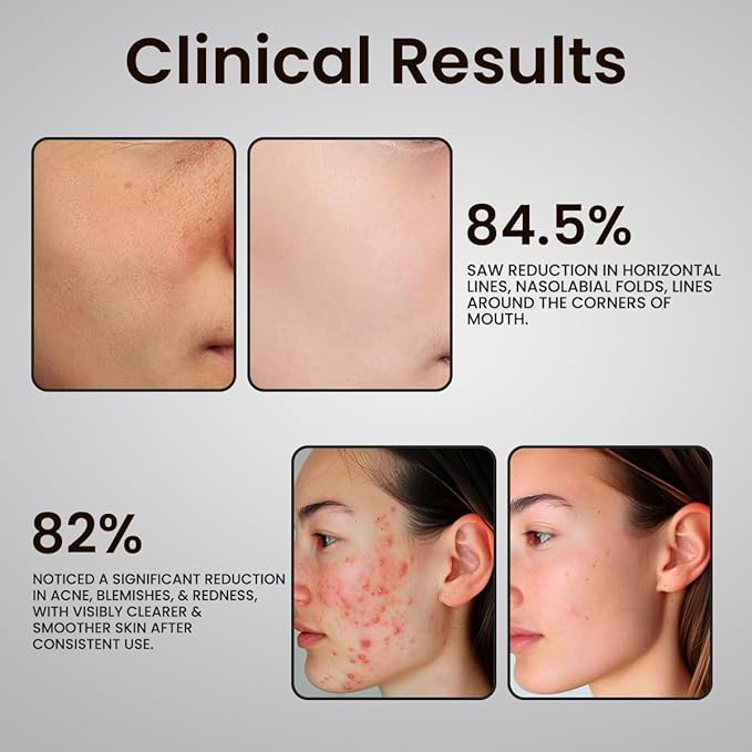 Glutathione Serum with 5+Peptides -20,000ppm Glutathione brightening 50X dark spot Serum for Face- Hyperpigmentation Serum, Anitoxidants B3,B5 C E Niacinamide fights Aging Signs [5 serum in 1]-Velvo Beauty