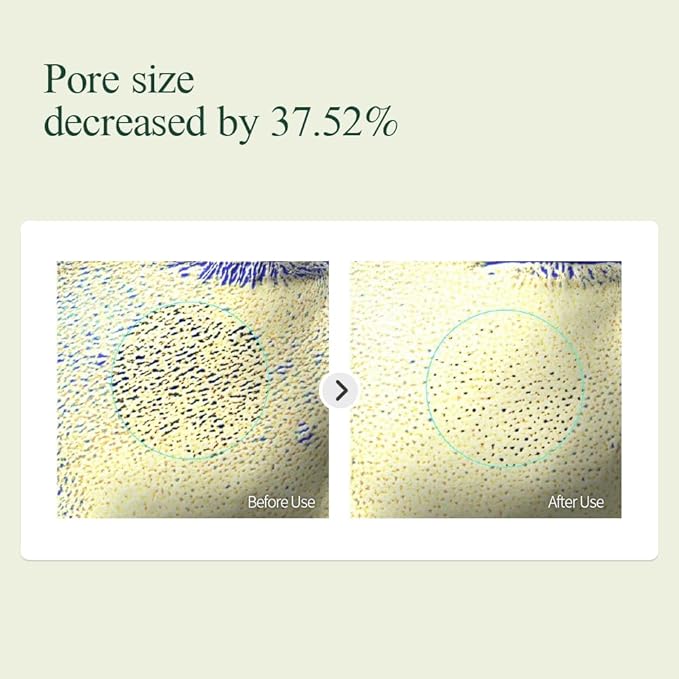 PYUNKANG YUL Calming Line Gift Box Set-Korean Facial Skin Care Essential for Daily Moisturizing with Toner, Serum, Cream, Safe on Acne Prone & Sensitive Skin, Vegan & Cruelty Free-Velvo Beauty