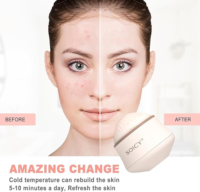 OPENDGO Facial Ice Roller 360° Rotating Massager Roller Ball Cooling Face Ice Roller for Reduce Puffiness and Relief Migraine, Pain,Ice Face Eye Massage Roller, Skin Care Tools-Velvo Beauty