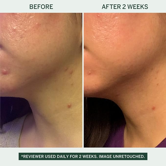 Urban Calm Collection Gift Set - Hydrating, Smoothing, Exfoliating, and Soothing Skincare Set for All Skin Types - Includes Fermented Skincare Products: Cleanser, Essence, Serum, and Cream-Velvo Beauty