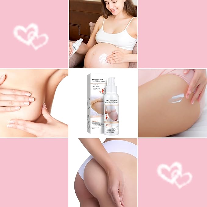 Stretch Mark Cream for Pregnancy - Brightening and Moisturizing with Collagen and Avocado Extract - Promotes Skin Elasticity and Fades Postpartum Stretch Marks - for Use on The Tummy, HIPS - 3.38 oz-Velvo Beauty