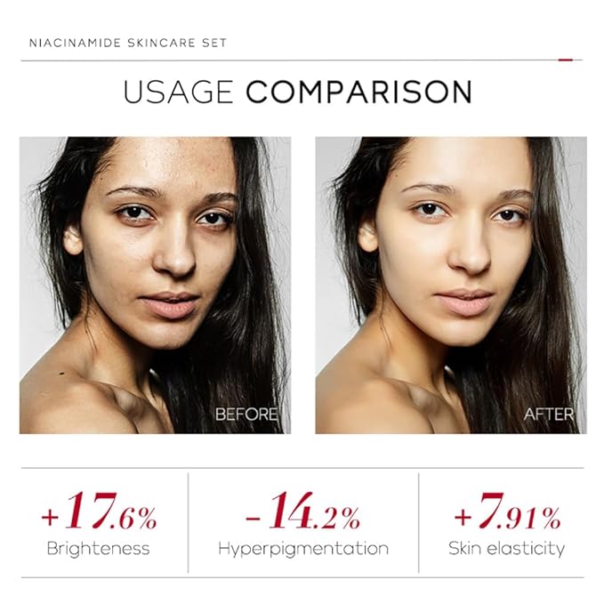 Niacinamide Skincare Set: 4pcs Beauty Kit with Cleanser, Toner, Serum, & Facial Cream - Hydrates & Evens Skin Tone - TSA-Friendly Travel Sizes, Perfect Gift for Women, Moms, & Teens-Velvo Beauty