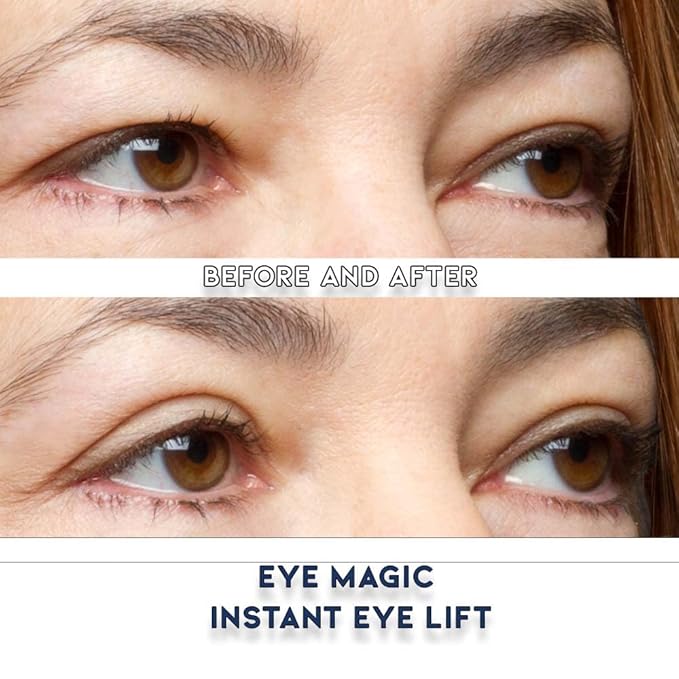 Eye Magic Premium Eye Lift (L/XL Refill) Made in America Lifts and Defines Droopy, Sagging or Hooded Eyes Safe For Daily Use-Velvo Beauty