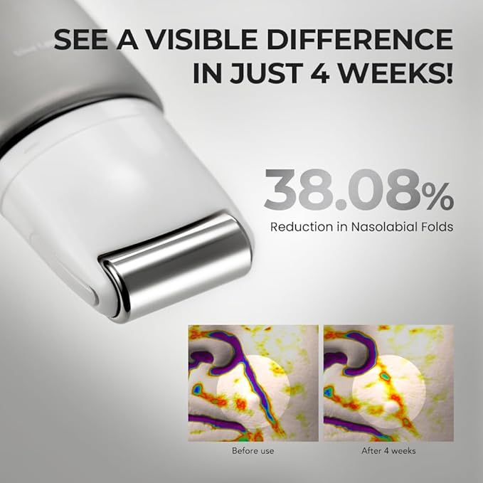 [SKIN&LAB] Retinol Lifting Roller Cream with Massage applicator, Vegan Anti Aging Face and Neck Cream for Reduce Wrinkles and Fine Line, For Face, Neck, Décolleté Wrinkle Care, 1.69 fl. oz.-Velvo Beauty