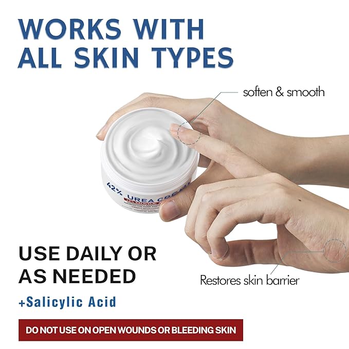 OUKEYA Urea Cream 42% plus Salicylic Acid 2% Net 5.29 Oz for Dry Cracked Feet,Heels,Knees,Elbows,Hands Repair Treatment Moisturizes and Removes Corns,Calluses,Dead Skin,and Softens Toenails-Velvo Beauty