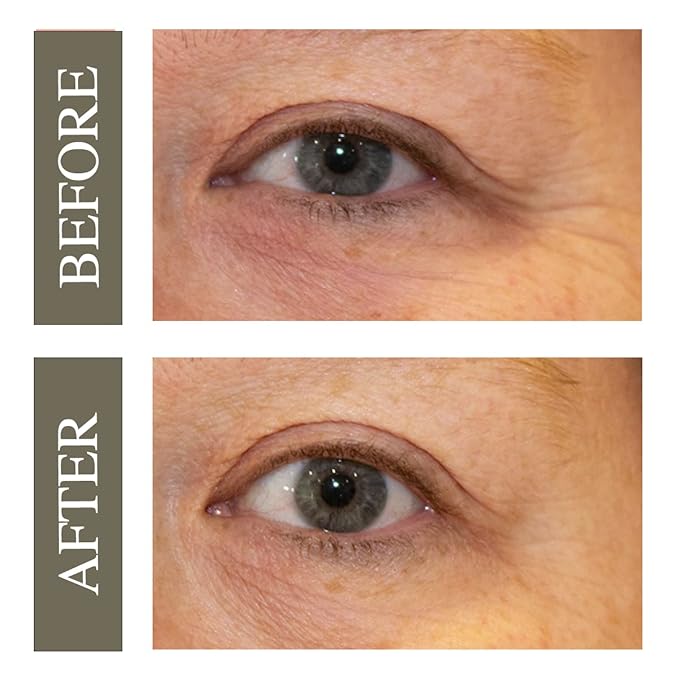 Hey Honey Open Your Eyes Lifting Eye Serum | Under Eye Cream for Dark Circles & Puffiness | Around The Eyes Hydration | Suitable For Sensitive Aging Skin | Delivers A Bright Rested look | 0.5 oz.-Velvo Beauty