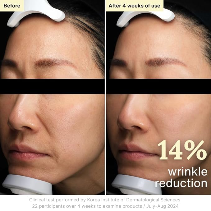 Rothea Resilience Cream, Anti-Aging with Bakuchiol 10,000ppm (Natural Retinol Alternative), Face Moisturizer, Neck Cream with Collagen, Ceramides, Peptides, Niacinamide, Korean Skin Care, 1.7 oz-Velvo Beauty