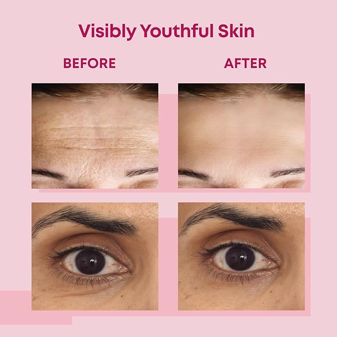 Bayside Forehead & Under Eye Wrinkle Patches Set | Hyaluronic Acid, Collagen & Vitamin E | Overnight Smoothing Treatment for Fine Lines & Wrinkles | Non-Invasive, Skin-Friendly Hydrating Care-Velvo Beauty