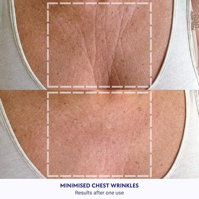 Wrinkles Schminkles Chest Wrinkle Patch & Cleanser Starter Pack - Set of Reusable Chest Silicone Wrinkle Patch + Patch Cleanser (2 oz) Maximise Uses - Smooth & Prevent Chest & Décolletage Wrinkles-Velvo Beauty