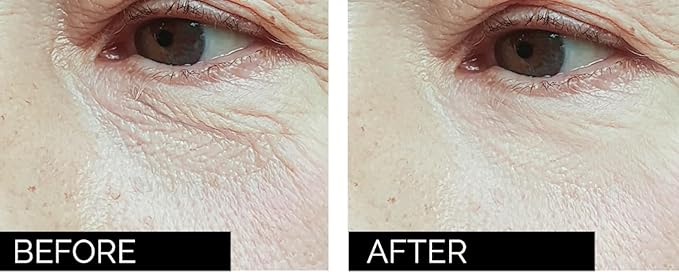 Anti-age under eye masks - With Hyaluronic Acid, Collagen & Vitamin C. Natural gel eye masks, under eye gel patches for dark circles & puffy eyes. Anti wrinkle skincare, hydrating & soothing. 20 pairs-Velvo Beauty