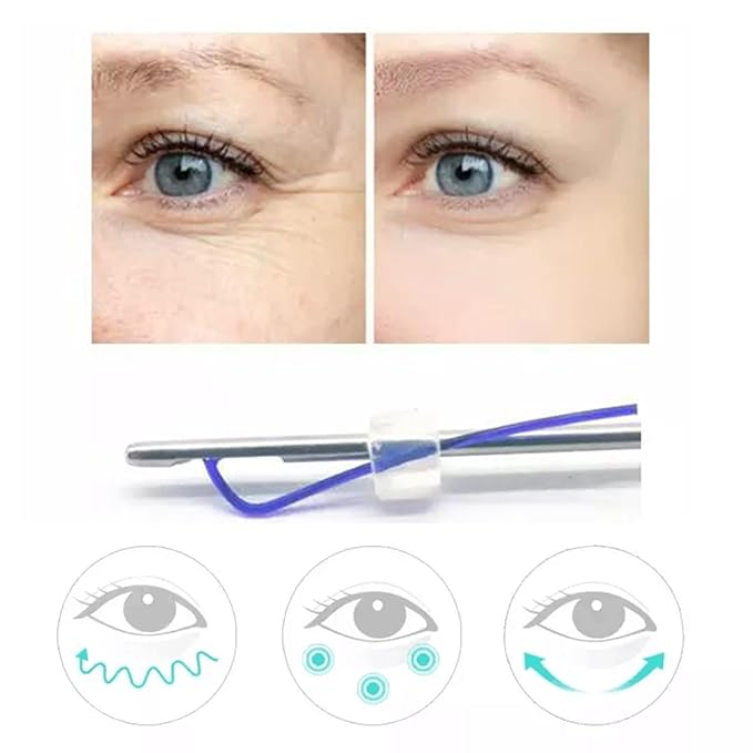 Pdo Threads Eye Lift for Eyes, Mono Screw Type, B-Type, 30G25MM, 20pcs-Velvo Beauty