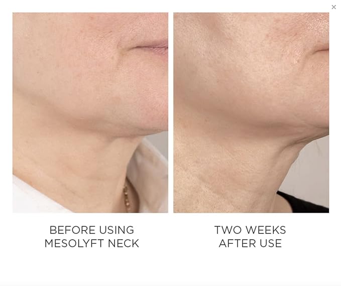 Power Combo Neck & eye Roller Brightening Face Serums for Anti-Aging Get Lip Pump's best Lip Plumper an Effectively Aging Skin Serum Multi-purpose, Eyes Neck & Décolleté Beauty Serum-Velvo Beauty