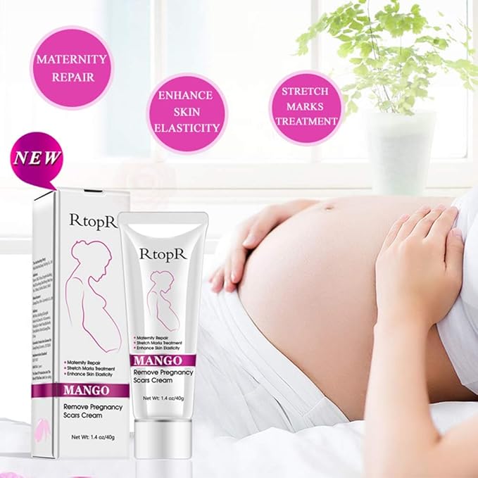 Mango Stretch Marks and Scar Cream, Stretch Marks and Scar Removal Cream for Pregnancy, Stretch Marks Scar Belly Creams for Wrinkles, Obesity Fat Stretch Mark Moisturizing, Remove Marks (40g)-Velvo Beauty
