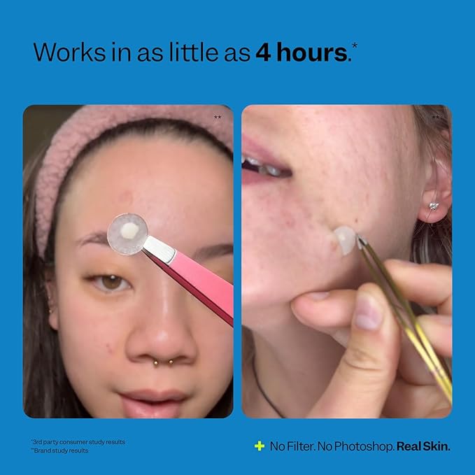 Peach Slices | Acne Spot Dots | Hydrocolloid Acne Patches | For Zits, Blemishes, & Breakouts | Vegan | Cruelty-Free | Pimple Patches | Facial Skin Care Products | 3 Sizes (7mm, 10mm, & 12mm) | 30 Ct-Velvo Beauty