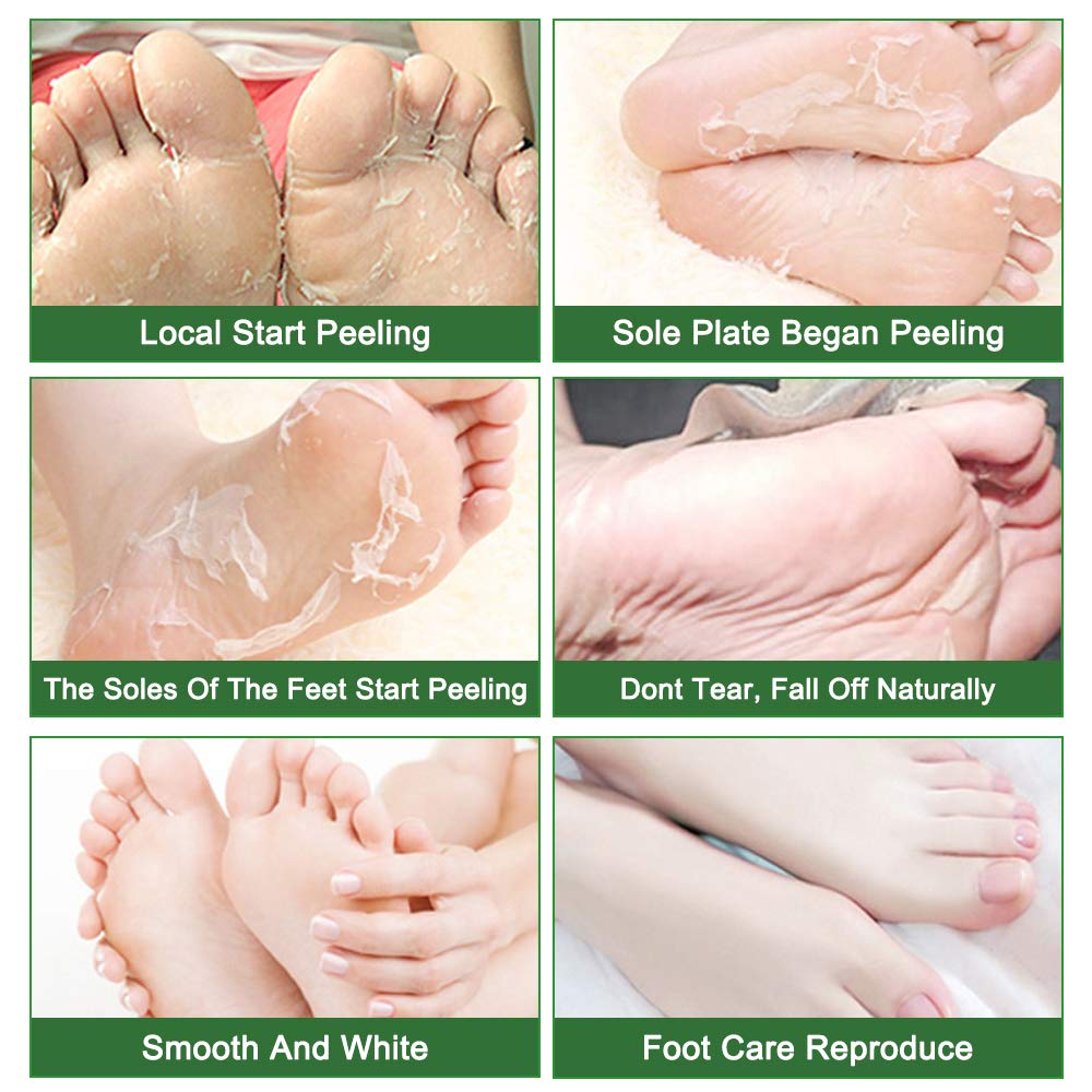 Foot Peeling Mask Moisturizing Socks 5Pairs, Foot Mask Remove Dead Skin, Rough Callus and Cracked Heels, Dry Skin Moisturizer for Soft and Smooth Baby Touch Feet (Tea Tree)-Velvo Beauty