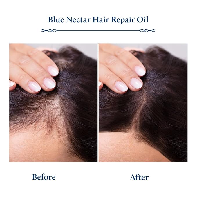 Blue Nectar Rosemary Oil with Bhringraj, Amla and 9 Herbs for Natural Hair Growth (6.76 Fl Oz)-Velvo Beauty